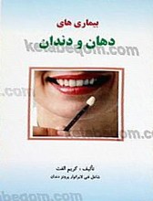 بیماریهای دهان و دندان
